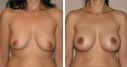 Before & After Photos